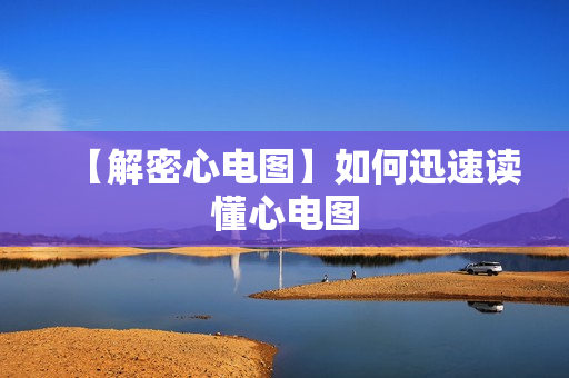 【解密心电图】如何迅速读懂心电图